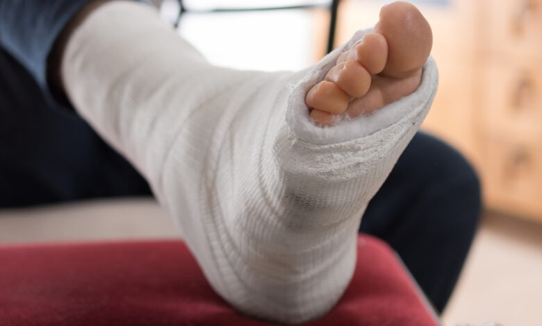 د. كريم عبد السلام يوضح: متى يحتاج الطفل إلى جبيرة لعظامه؟