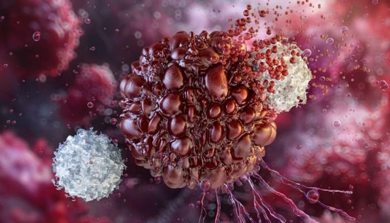 علاج الأورام في عصر الطب الحديث… الأمل يتجدد مع تقنيات المناعة والعلاج الموجّه