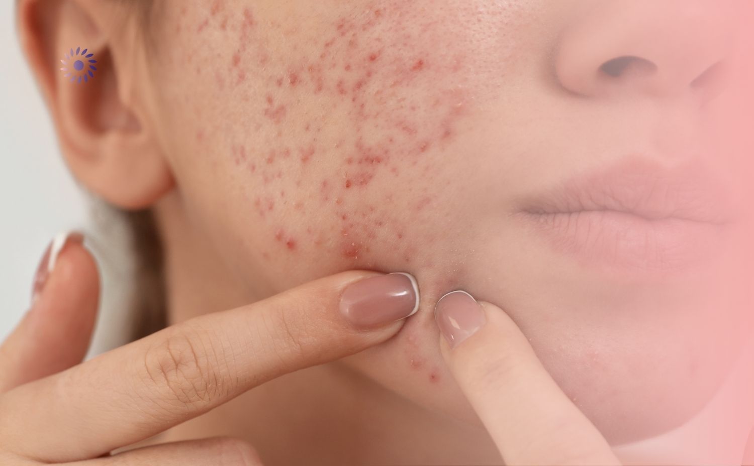 علامات جلدية لا يجب تجاهلها