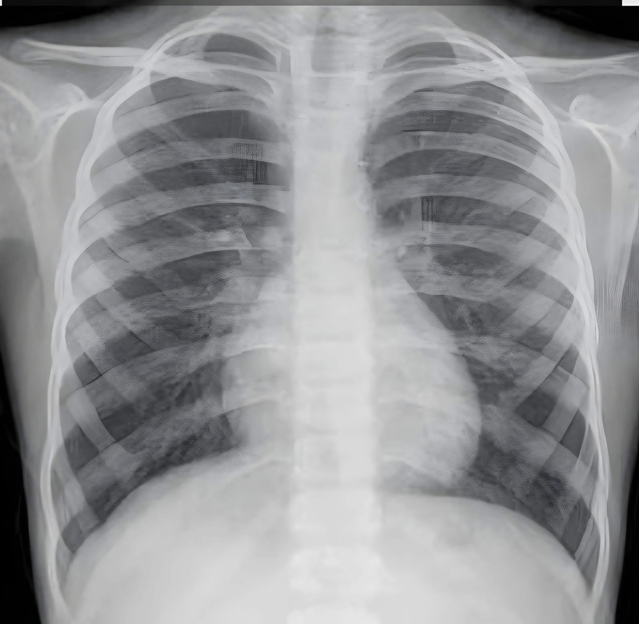 من دور برد بسيط إلى فشل عضلة القلب.. قصة تحذيرية لا يجب تجاهلها