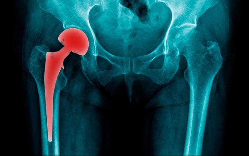 ألم الحوض المستمر لا يُستهان به.. تحذيرات أطباء من مضاعفات التهاب الحوض