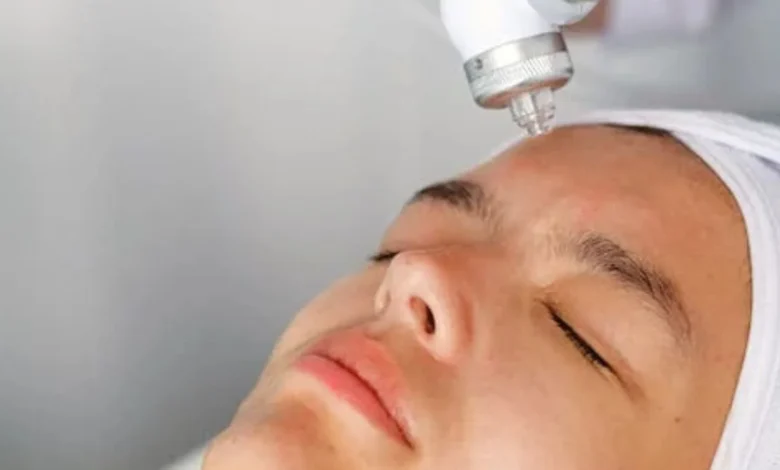 د. هبة حسين: ليه الفراكشنال CO2 بقى الحل السحري لمشاكل البشرة؟