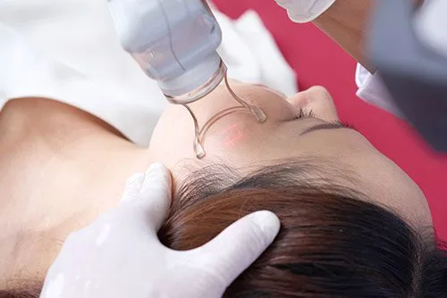 د. هبة حسين: ليه الفراكشنال CO2 بقى الحل السحري لمشاكل البشرة؟