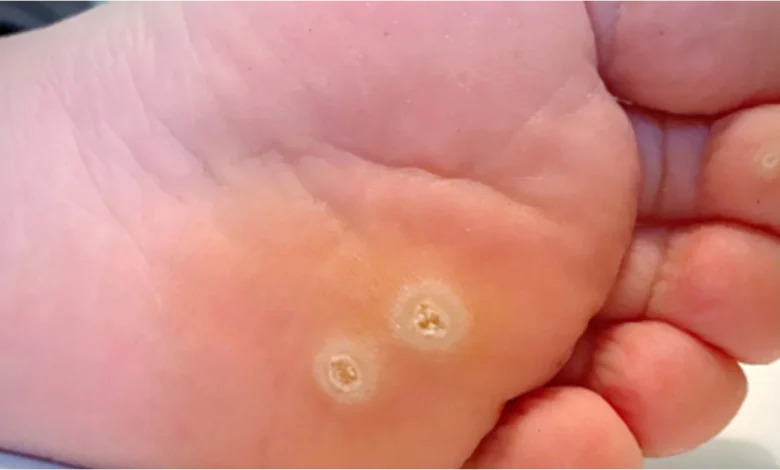 د. هبة حسين: عين السمكة مش بس للأطفال.. البالغين معرضين لها كمان| أحدث طرق للعلاج فعالة